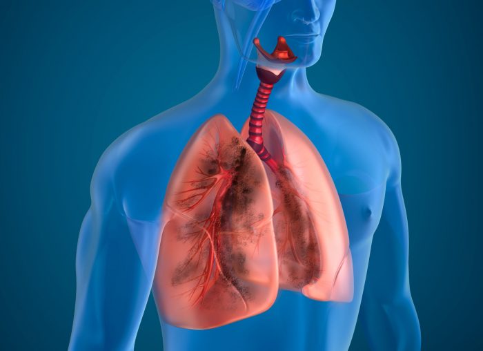 pulmones